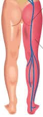 Vein Centers