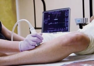 Picture of a vein specialist using an ultrasound to assess a patient's varicose veins 