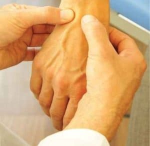 Doctor assessing the veins on the back of a patient's hand