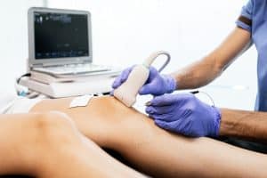 vein ultrasound